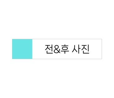 아우라 플라즈마 이미지